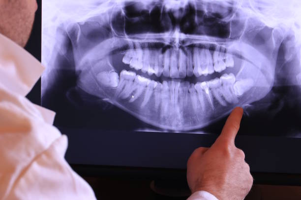 Best After-Hours Emergency Dentist in New Knoxville, OH