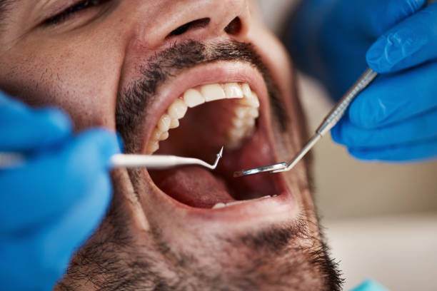 Best Emergency Dental Surgery in New Knoxville, OH