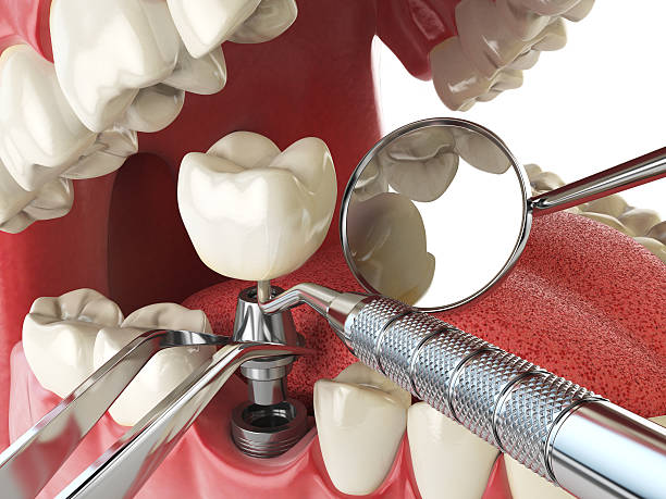 Best Same-Day Emergency Dentist in New Knoxville, OH